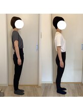 ピラティストトヤセ 三軒茶屋店/整体×ピラティス1ヶ月の変化◎