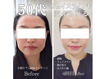 フレル(FUREL)の写真