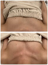 美人バスト 渋谷店/【バストアップ・育乳】20代☆