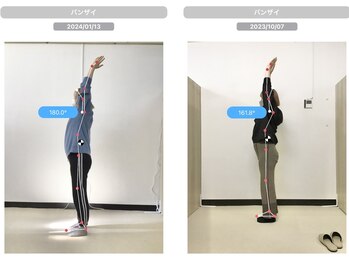 ナオル整体 国分寺院(NAORU整体)/20代女性　【AI分析　肩こり】