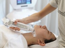 アメリ―ボーテ 恵比寿(Amelie beaute)/気になる顎下もサーマトリックス