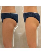 パウ(Paw)/変化写真