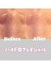 【頑固な毛穴をつるぴか毛穴レス】ハイドロスプラッシュ　　¥8800