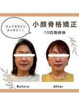 たなごころ整骨治療院 整体院/小顔矯正