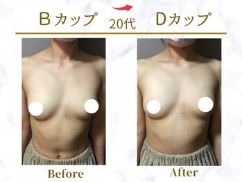 Ms.やまとなでしこ/ビフォーアフター