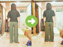 サプライズ整体院/20代ママの初回産後の骨盤矯正