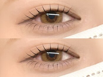 縁と縁(enn to yukari)/中顔面短縮デザイン！