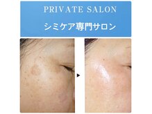 ビューティーガーデン(Beauty Garden)