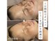 アンリミット(Unlimit)の写真