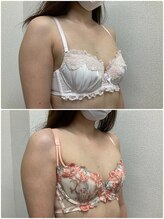 バーディー(BIRDIE)/施術3回/30代