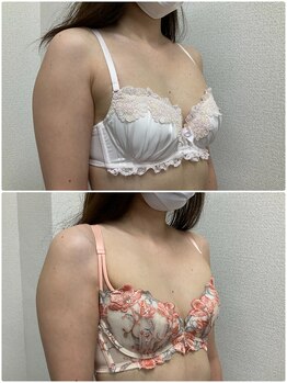 バーディー(BIRDIE)/施術3回/30代