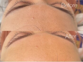 シス(sis)/パーツワックス◇額