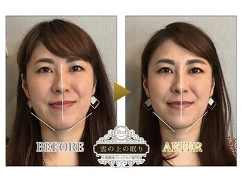 雲の上の眠り/ビフォーアフター１