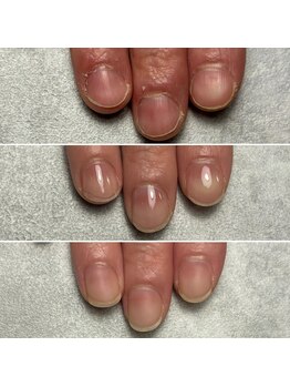 飲食店でネイルNGでも育成できた