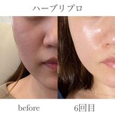 アリュール(Allure)