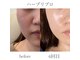 アリュール(Allure)の写真