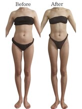 リカバリー(&recovery)/ダイエットrecovery/骨洗浄