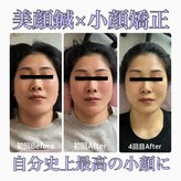 ビプラス(BePlus)