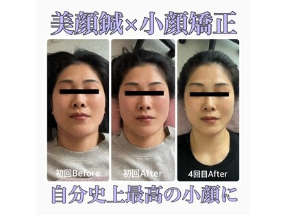 ビプラス(BePlus)の写真