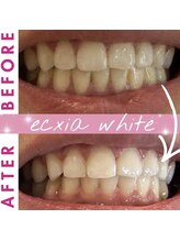 エクシアホワイト 長野店/