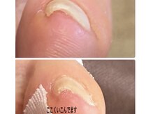 ノエ(Noe’)の雰囲気（ジェル仕上も奇麗にできる、ネイリストが仕上げる技　小さい爪も）
