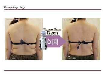 Nビューティー/最新エンダモロジーBODY