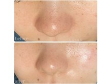 ちらちゅら/クリスティーナ【ビオフィート】