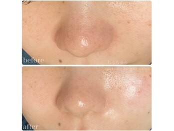 ちらちゅら/クリスティーナ【ビオフィート】