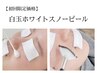 【白玉ホワイトスノーピール】都内人気の肌質改善/肌管理13200円→特別8800円