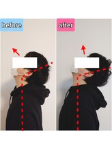 エンビジョン(ENVISION)/before→after