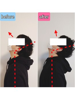 エンビジョン(ENVISION)/before→after