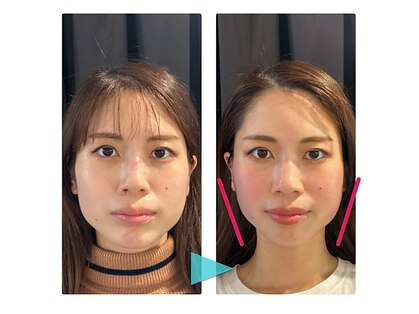 リフェイス(Re:face)の写真