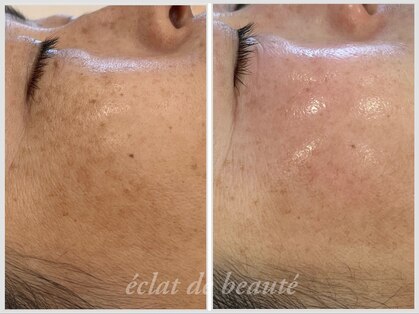エクラデボーテ(eclat de beaute)の写真