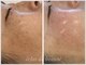 エクラデボーテ(eclat de beaute)の写真