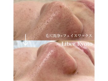 リベルキョウト 京都駅前店(Liber Kyoto)/タマゴ肌コース