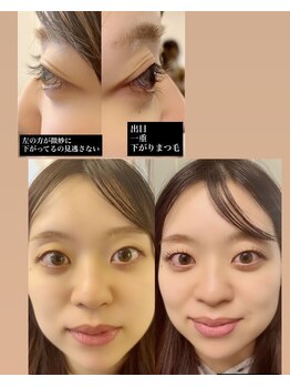 グロウビューティー(grow beauty)/