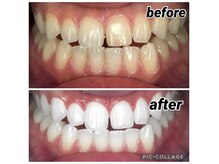 【気になる黄ばみ、今こそリセット】