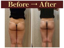 クオレ(CUORE)/ビフォーアフター