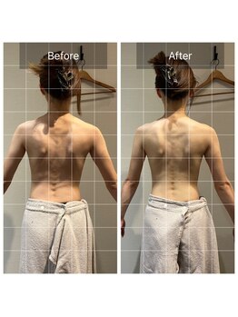 ロッタ エクリュ(Lotta ecru+)/筋膜リリースマッサージ