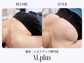 エムプリュ 心斎橋店(M.plus)/プレミアムバストコース3回目