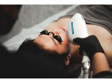 ビーフリー(Be Free)/メンズ髭脱毛