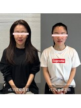 プライミー(PRIMY)/小顔矯正！ビフォーアフター