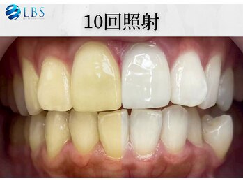 LBSホワイトニング 吉祥寺店