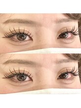 バニーアイズ 天神(Bunny eyes TENJIN)/フラット140本