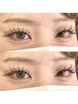 バニーアイズ 天神(Bunny eyes TENJIN)/フラット140本