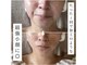 アンリミット(Unlimit)の写真