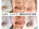 んまちの写真/<韓国式3D毛穴洗浄>自己流の毛穴ケアしていませんか??押し出さず浮かせる施術で毛穴がすっきり引き締まる★