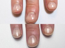 プラスミー(+me)/自爪育成