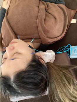 ハリファ鍼灸院 横浜関内院(HariFa鍼灸院)/美容施術