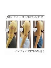 インディバケアプラチナム 横浜店/インディバ施術